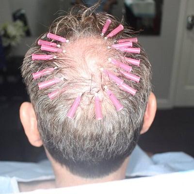 Hair Threads Therapy